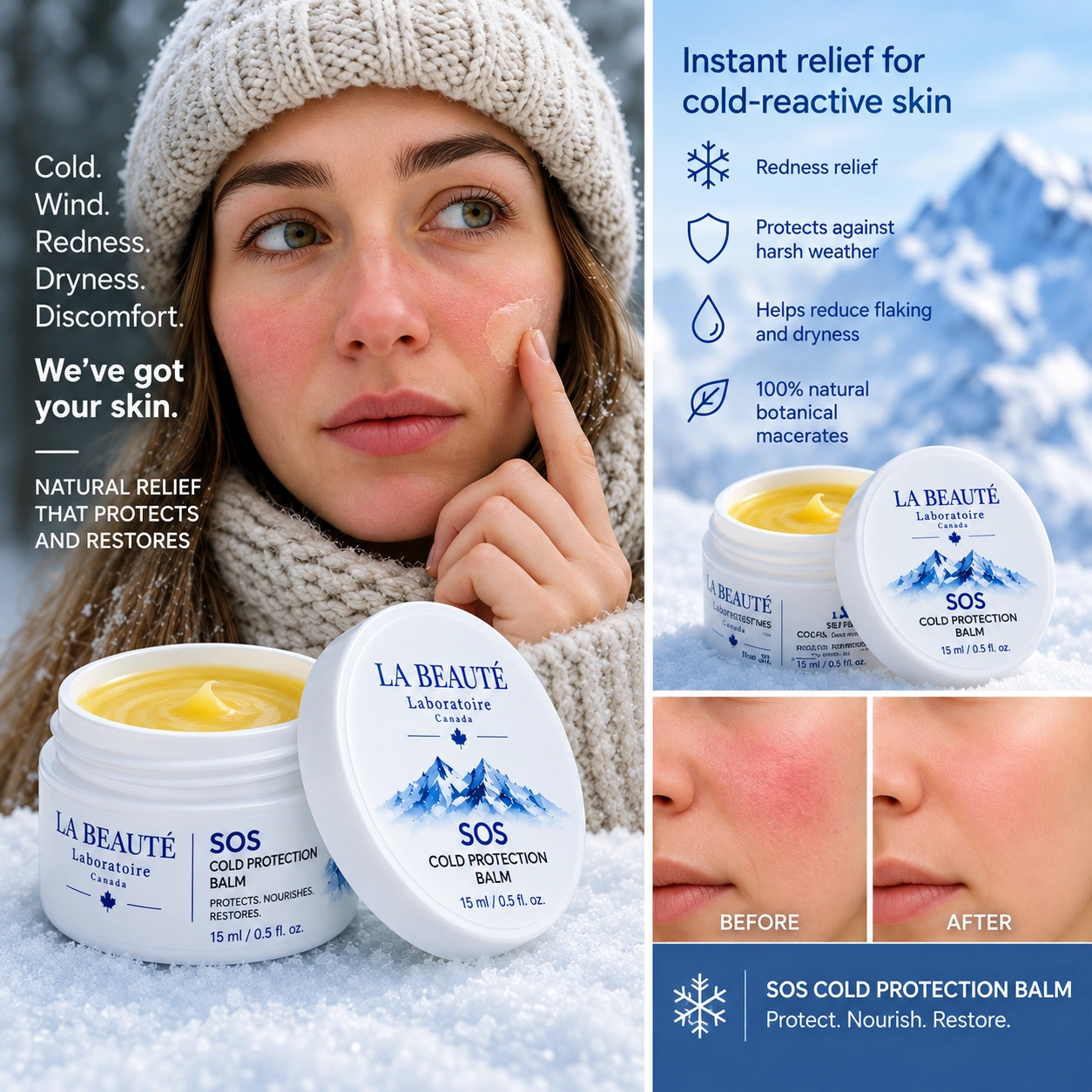 SOS COLD PROTECTION BALM — 15 ml - Image 2